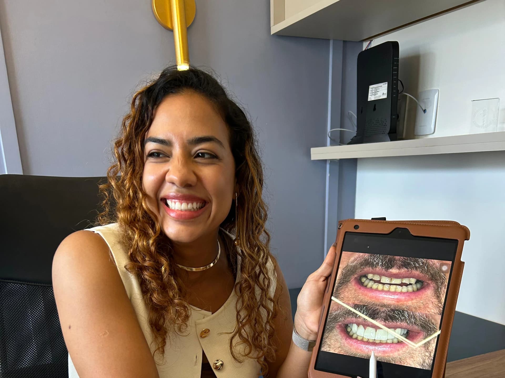 Caso clínico de estética dental e harmonização orofacial – Dra. Maria Santana Salvador