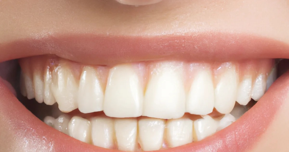 Close de um sorriso com a gengiva aparecendo acima dos dentes superiores